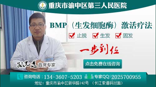 重庆哪个医院看斑秃好